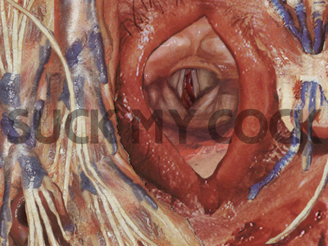 Typhoid Mary screenshot